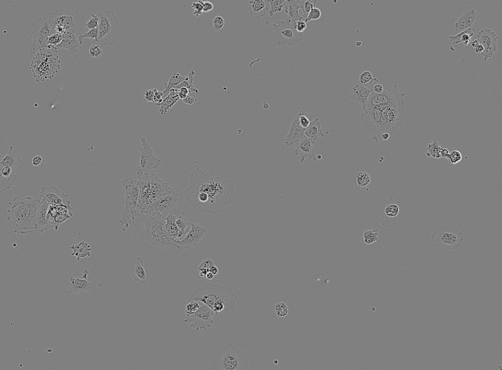 Huh7 microscope photo in the training group.